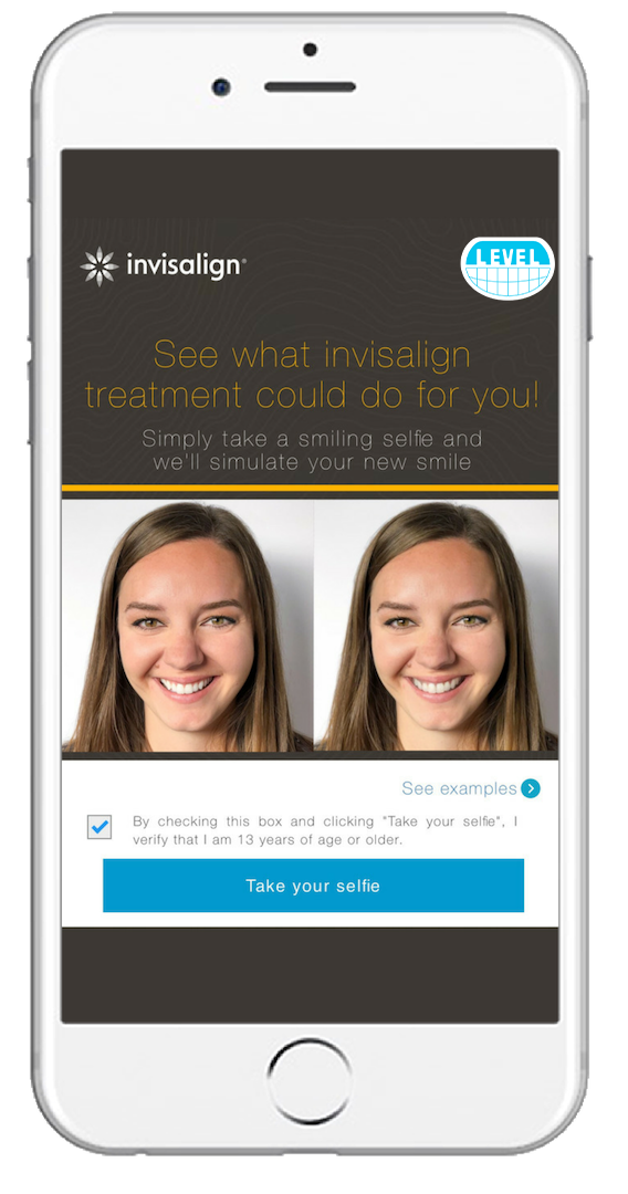 SmileView Invisalign 