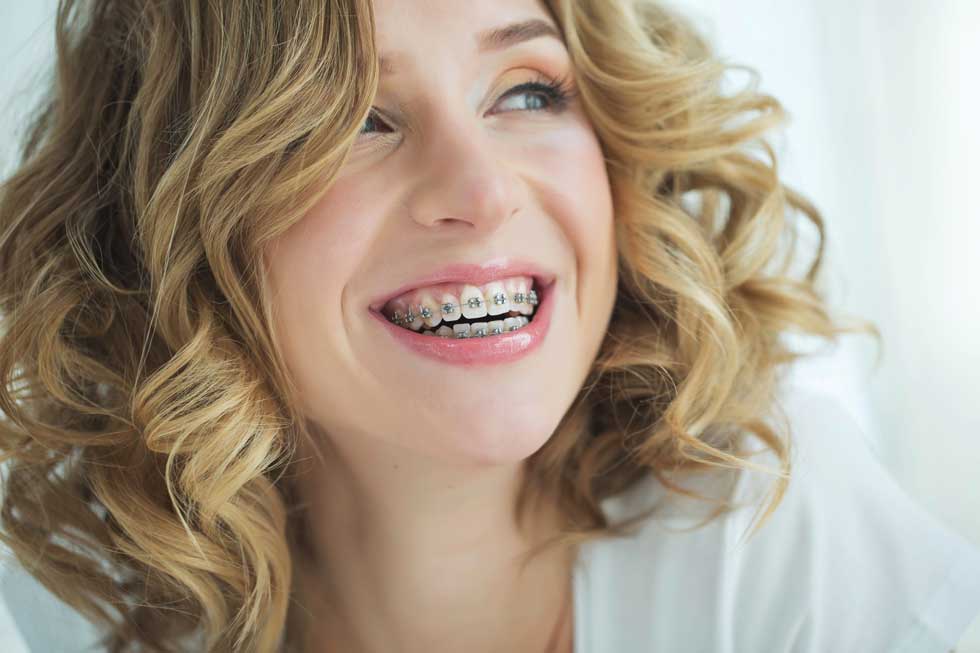 Adult Braces: What Are the Options? Edmonton, AB