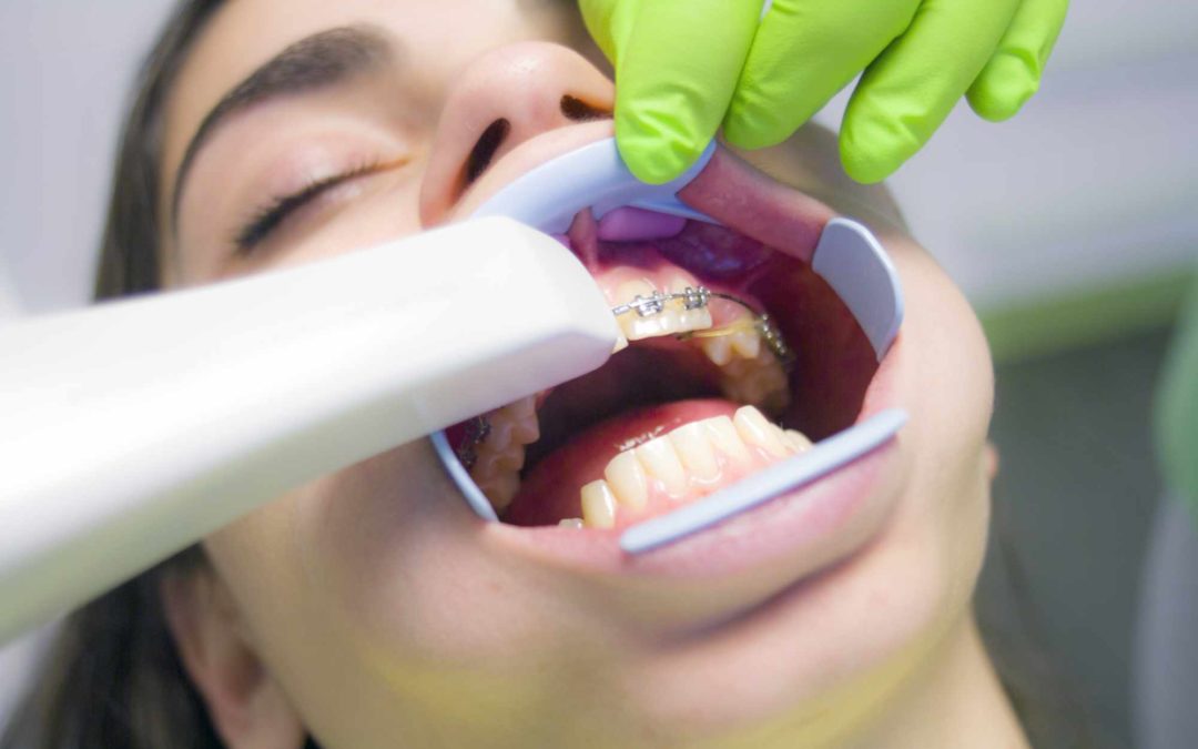 7 Steps to Effective Orthodontic Treatment and a Straighter Smile