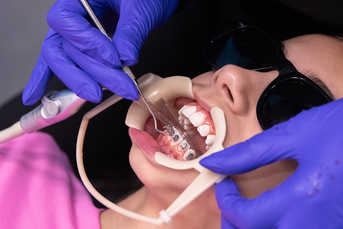 orthodontic treatment for teens
