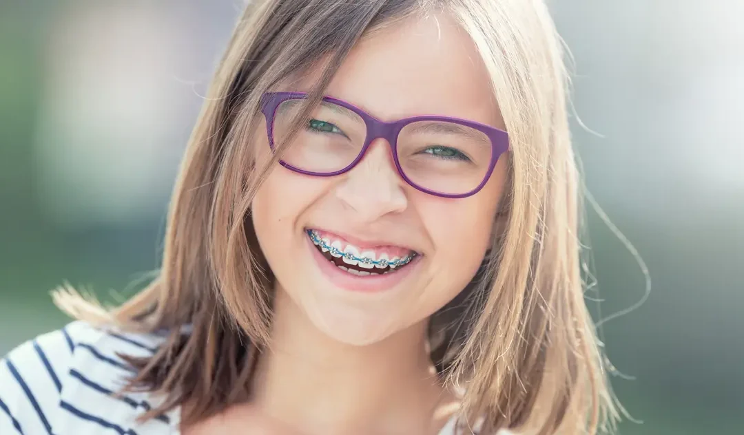 Braces Care Made Simple: A Guide for Parents