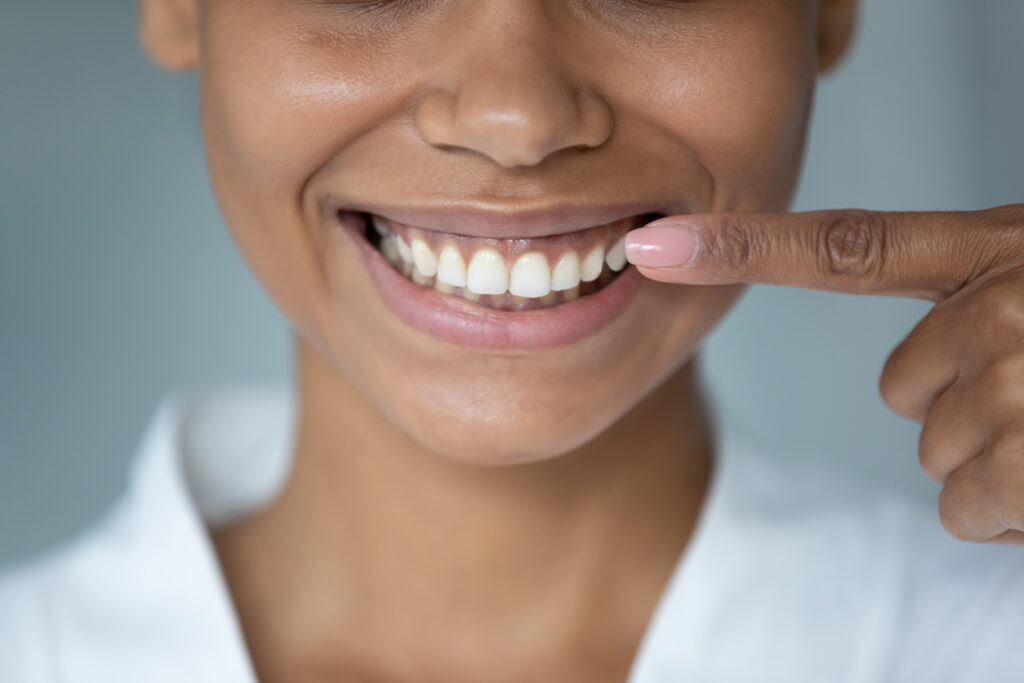 woman pointing to her smile