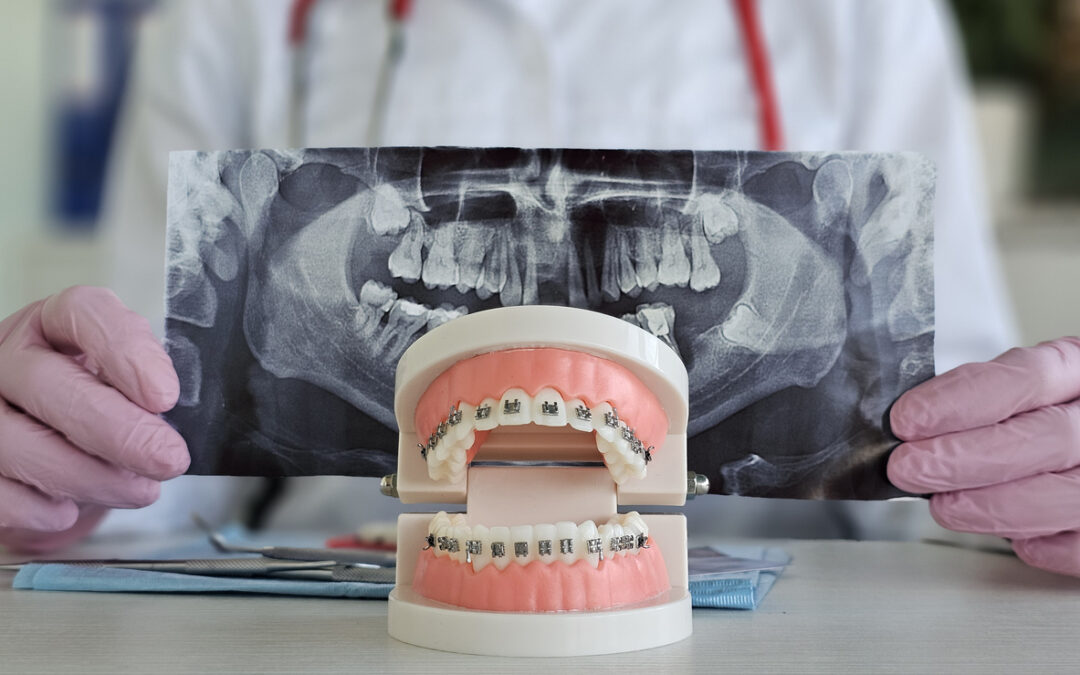 The Connection Between Orthodontics and Better Overall Health