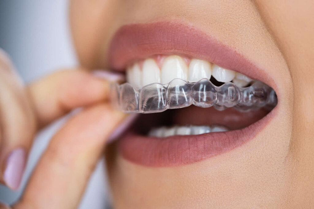 Clear Aligner Dental Night Guard For Teeth