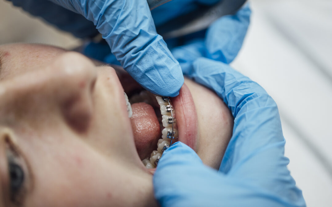 The Best Age To Start Orthodontic Care